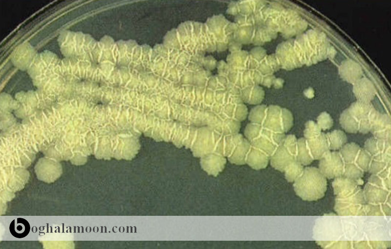 باکتری کورینه باکتريوم اولسرانس