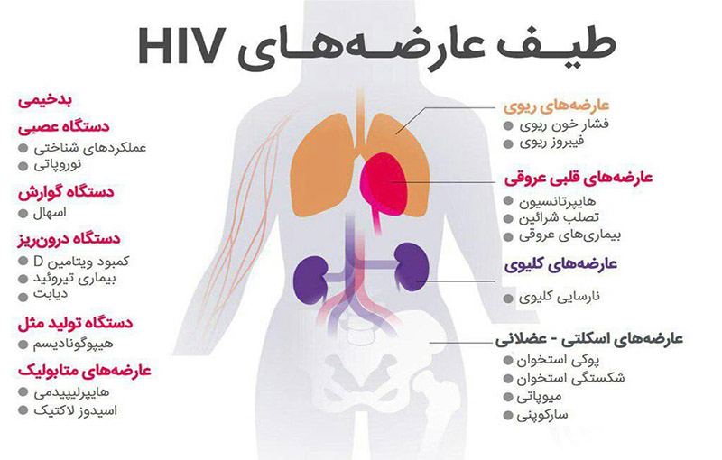 ویروس نقص ایمنی انسان (HIV)