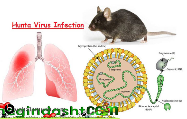 بیماری تب ناشی از گاز گرفتگی موش