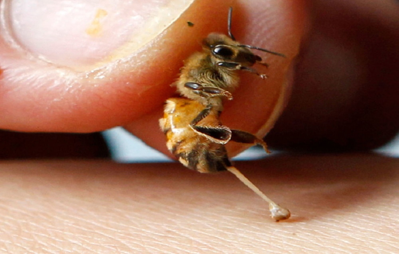 موارد تجویز زهر زنبورعسل