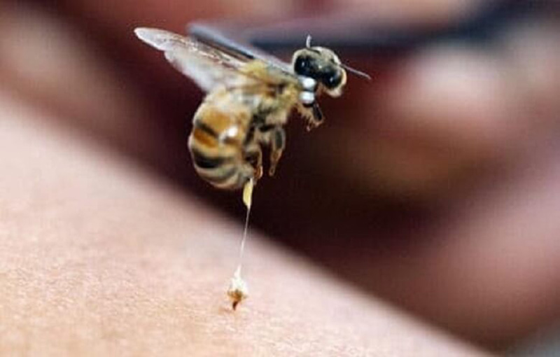 تکنیک­های کاربرد زهرزنبور عسل برای اثرات درمانی آن